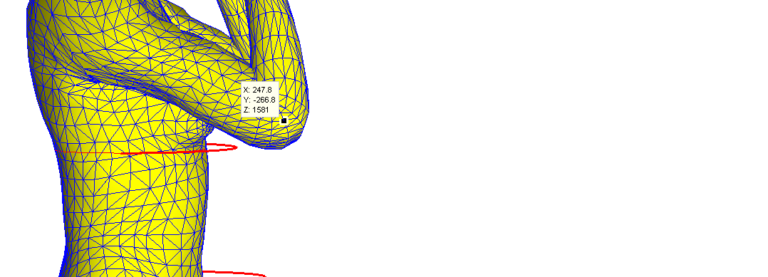 Visuel Déformation enveloppe externe