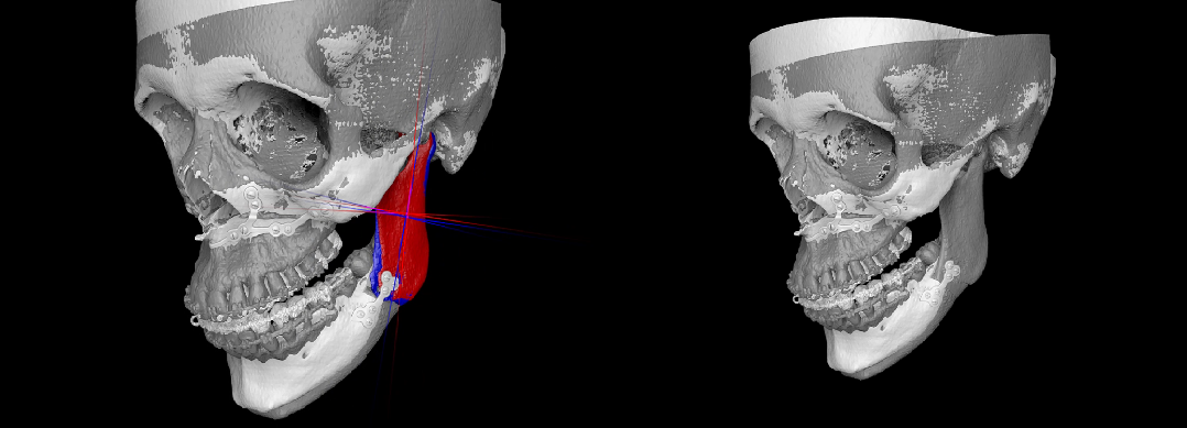 Visuel Mandibule