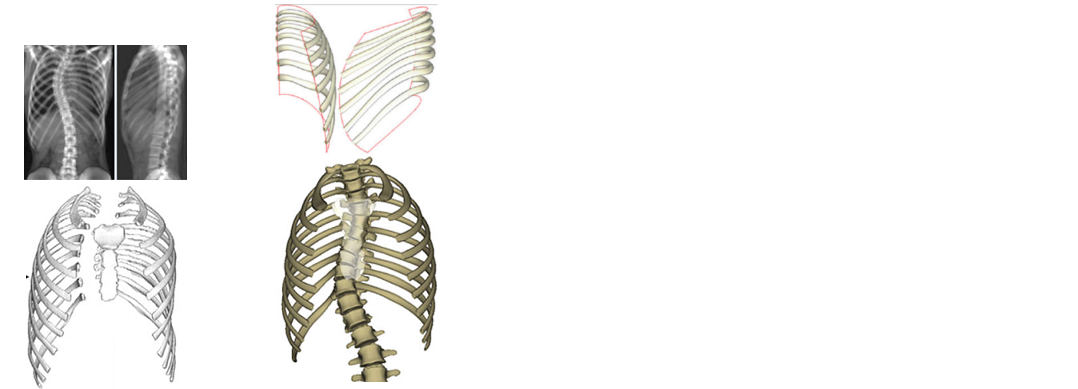 Visuel Thorax