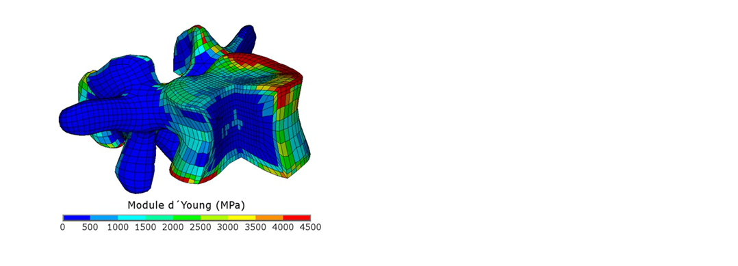 Visuel Modèle éléments finis de vertèbre