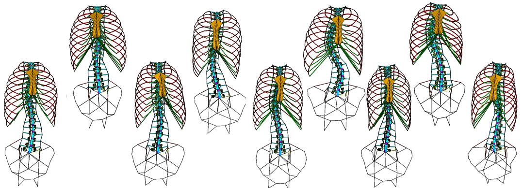 Visuel Modèle scoliose